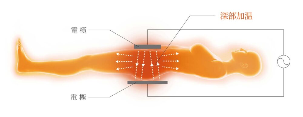 インディバの特徴「深部加温」の図解